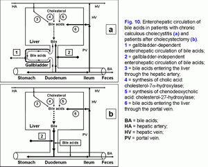 Enterohepatic circulation of bile acids, chronic calculous cholecystitis